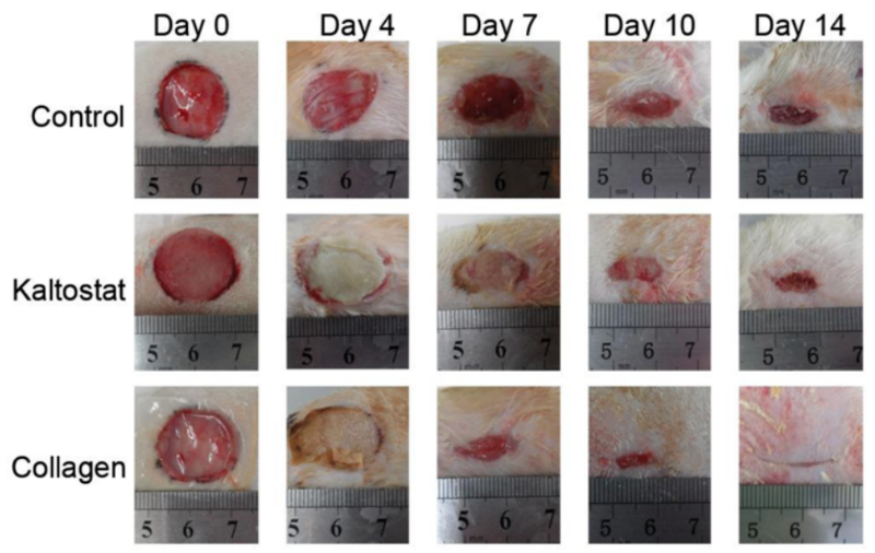 Fish Collagen 'Band-Aid' Can Heal Your Wounds 2 wound heal