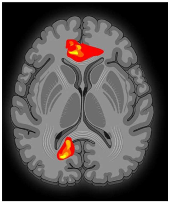 The music you listen to physically reshapes your brain, according to neuroscience 3 brainsci 13 01390 g001 550