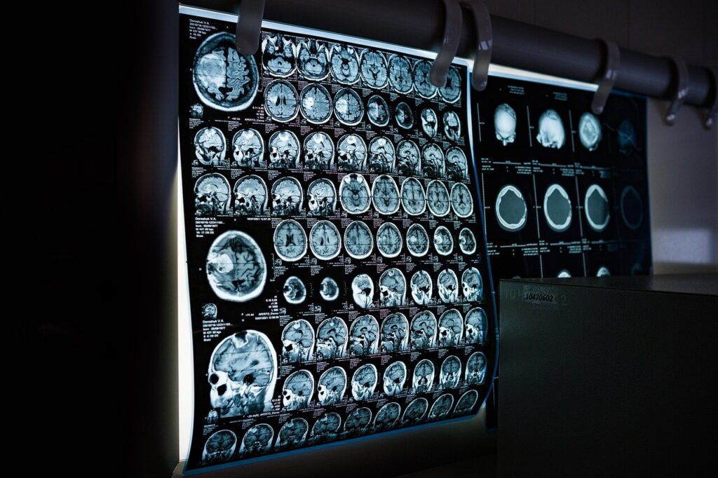 x ray 6841384 12801